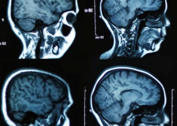 Darren Waller – All In Your Head (Music Video) Taken Off: Mind Games: It’s All in Your Head EP (iTunes/Spotify)